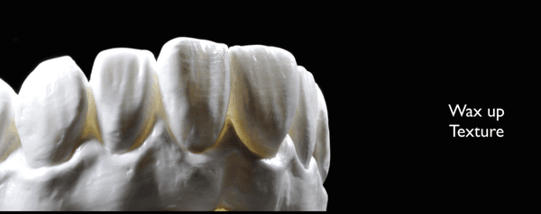 Every tooth receives the highest level of attention during design. This is a wax up prior to making the final restorations. texture & form!