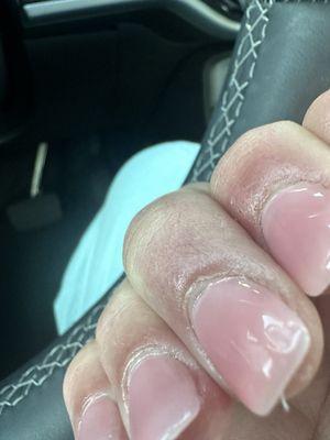 Bad nails