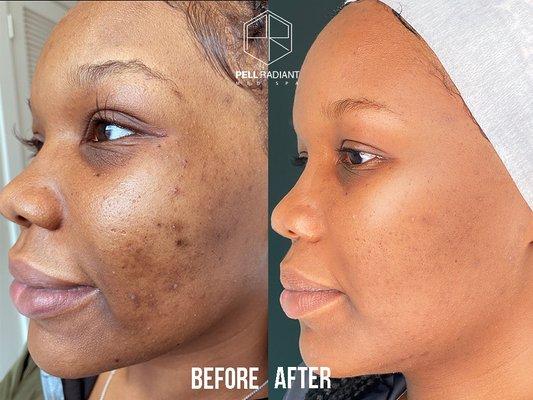 Pigmentation is no longer an issue at PellRadiant