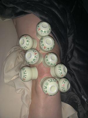 Cupping therapy for Knee Pain