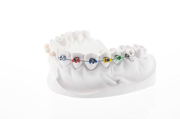 Simpli5 Orthodontics