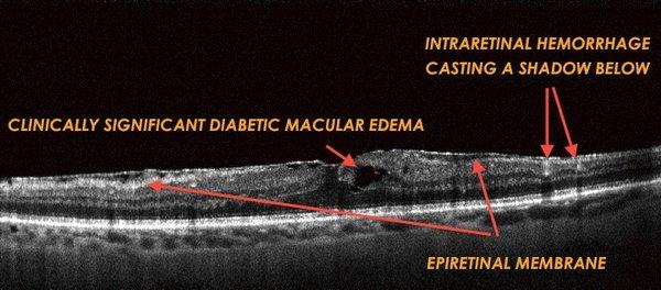 OCT - highest levels of technology at Master Eye