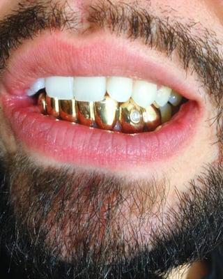 8 bottom grillz with a center VS1 diamond on canine. -AB Golds