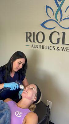 RF Microneedling for tightening, smoothing and improving skin texture