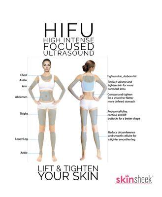 HIFU for face and body lifting.