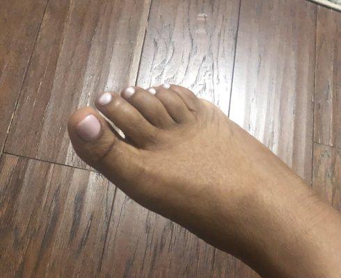 Pedicure results