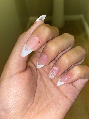 cuts around cuticle