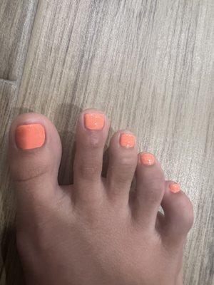 Right pedi