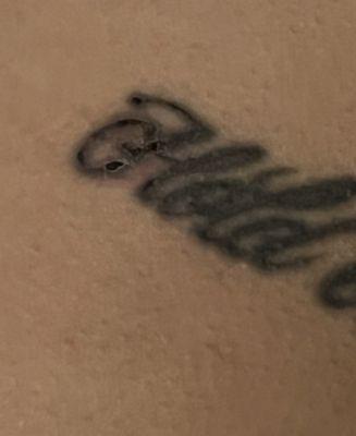 The peeling has since removed the ink in that area of my tattoo will upload a recent photo