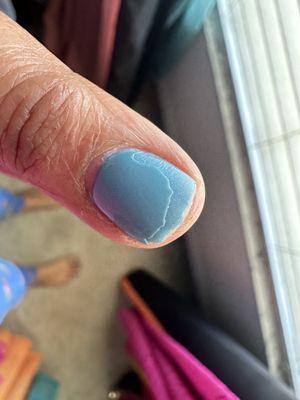 An hour after repairing nail