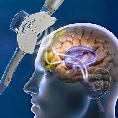 NeuroStar TMS Advanced Therapy