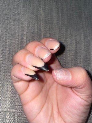 Chipped nails