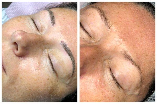 petite arch Microblading before and after