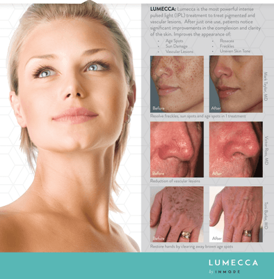 Lumecca for all types of skin conditions, call today for a free consultation.