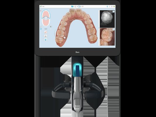 No more messy impression materials! Itero Scanner