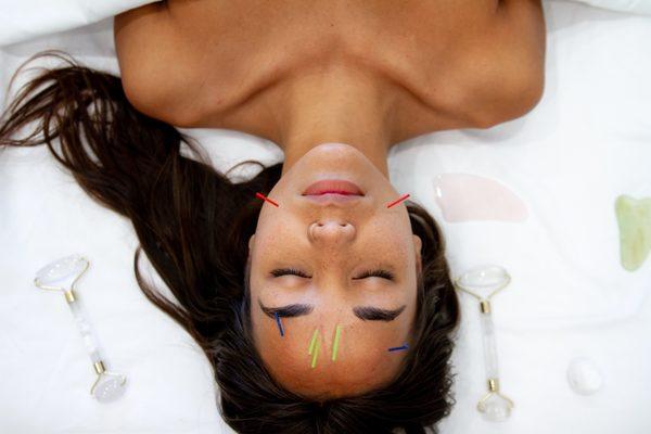 Facial Acupuncture in San Diego