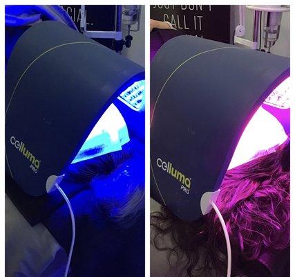 Celluma light therapy, helps with acne and anti-aging!