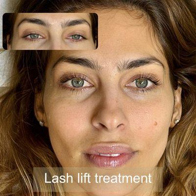 Lash Lift