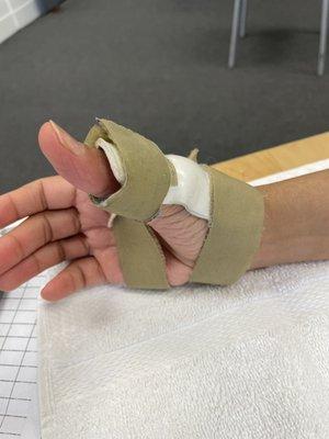 Splint for right thumb