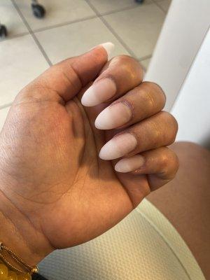 Crooked nail, lifted nails