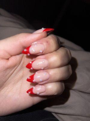 Horrible nails