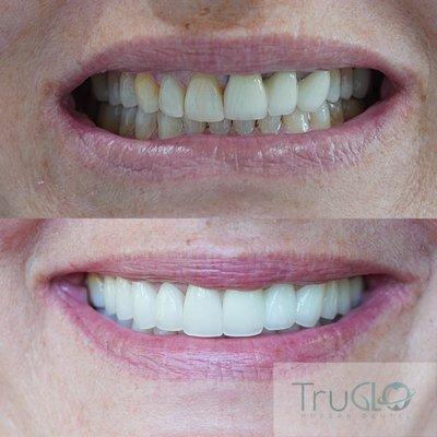 TruGlo Modern Dental