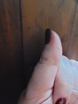 Filed side of nail I believe to far up nail and took off polish.