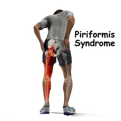 Buttocks muscle pain, hip, knee, ankle pain, hip to toe pain.