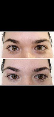 Eyelash lift