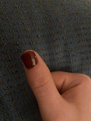 Chipped nail