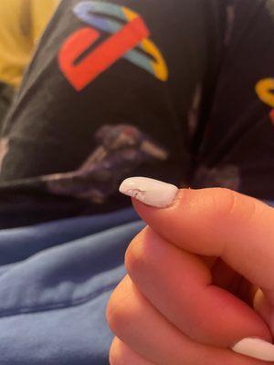 The chipped polish on my thumb nail.