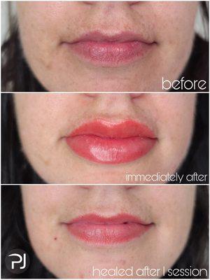 Lips coloring tattooing healed