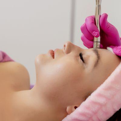 Microdermabrasion