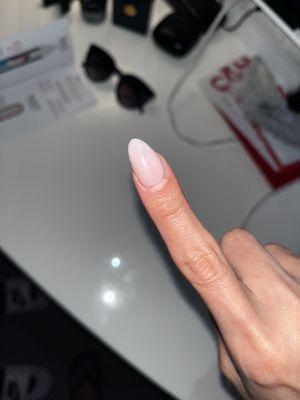 Acrylic nail lifting.