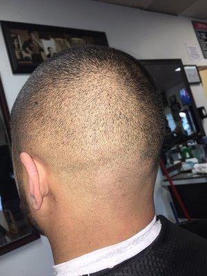 BALD FADE