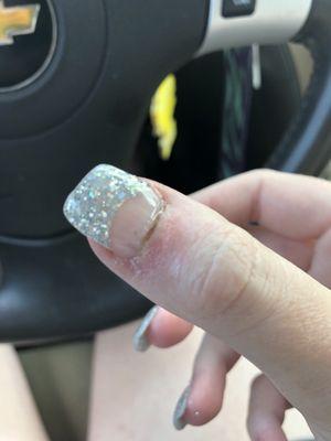 Badly cut cuticles