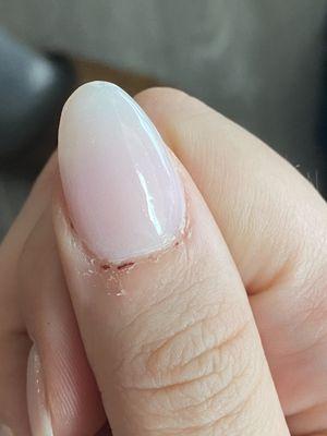 Cut cuticles