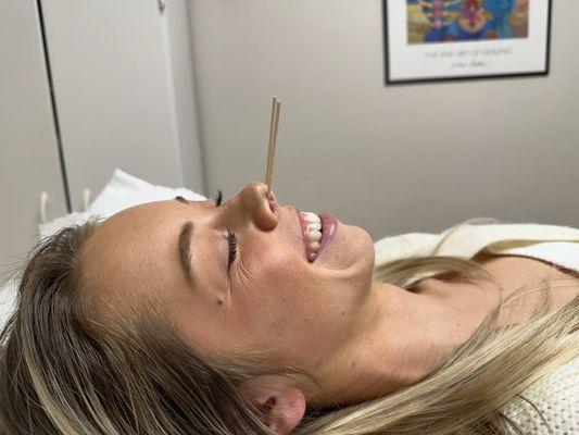 Woman getting nerve block treatment