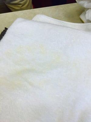 Stains on my bath towel. The owner claimed these were stains from body oil that become visible only after washing.