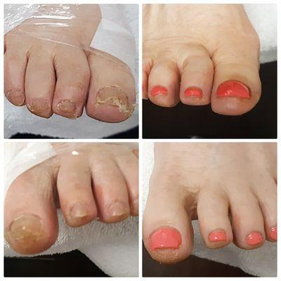 Dry skin build up, and a callus removal addons. Dry Pedicure.