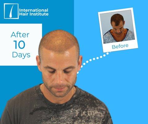 Our client after 10 days!!