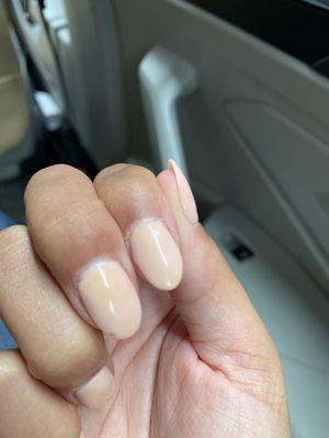 Chipped nail, color turning yellow after 3 days.