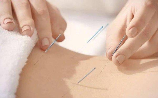 Acupuncture can help with weight loss by regulating hormone production, improving the metabolism, optimizing digestion, suppressing appetite