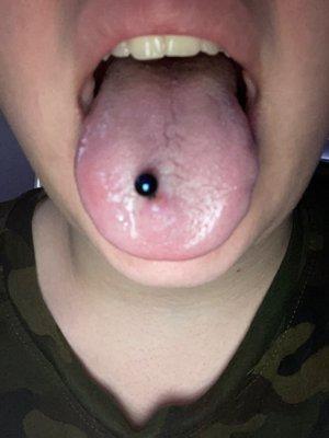 A messed up piercing.