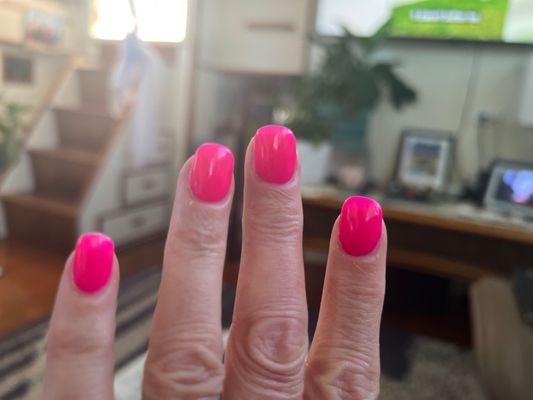 The after picture - short crooked nails