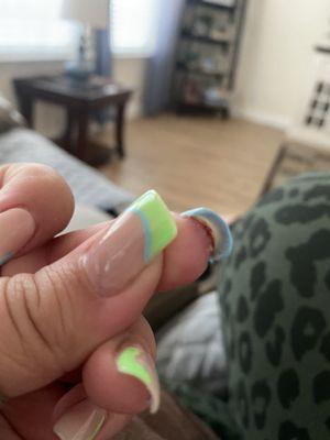 Blood exposure from broken nail