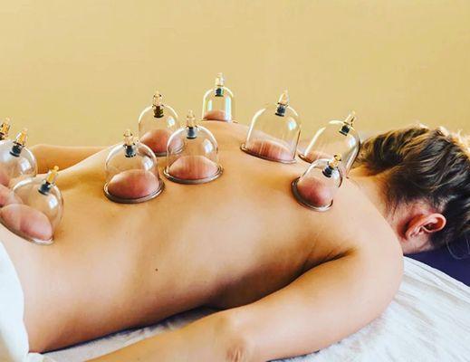 Cupping can be thought of as the inverse of massage. Call today for details