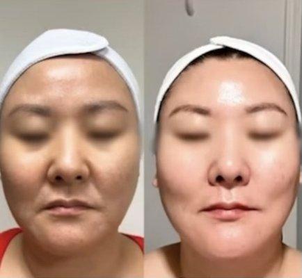 Timeless peel instantly brightens and firms skin