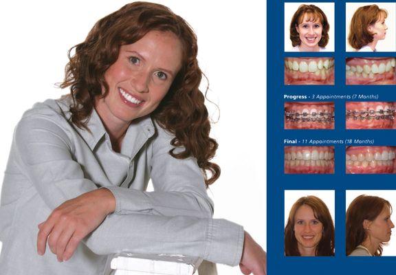 Explore the difference life brings with a beautiful smile form Garlock Orthodontics.