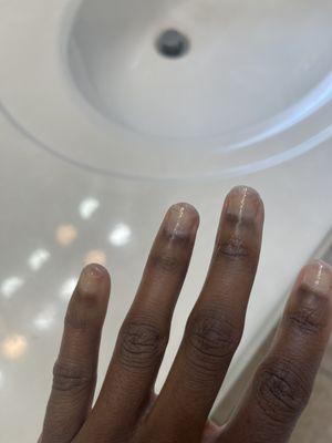 nails in pain due to nail tech rushing